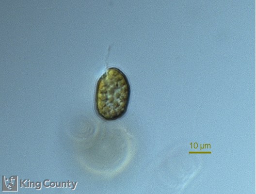 Photo of Heterosigma akashiwo